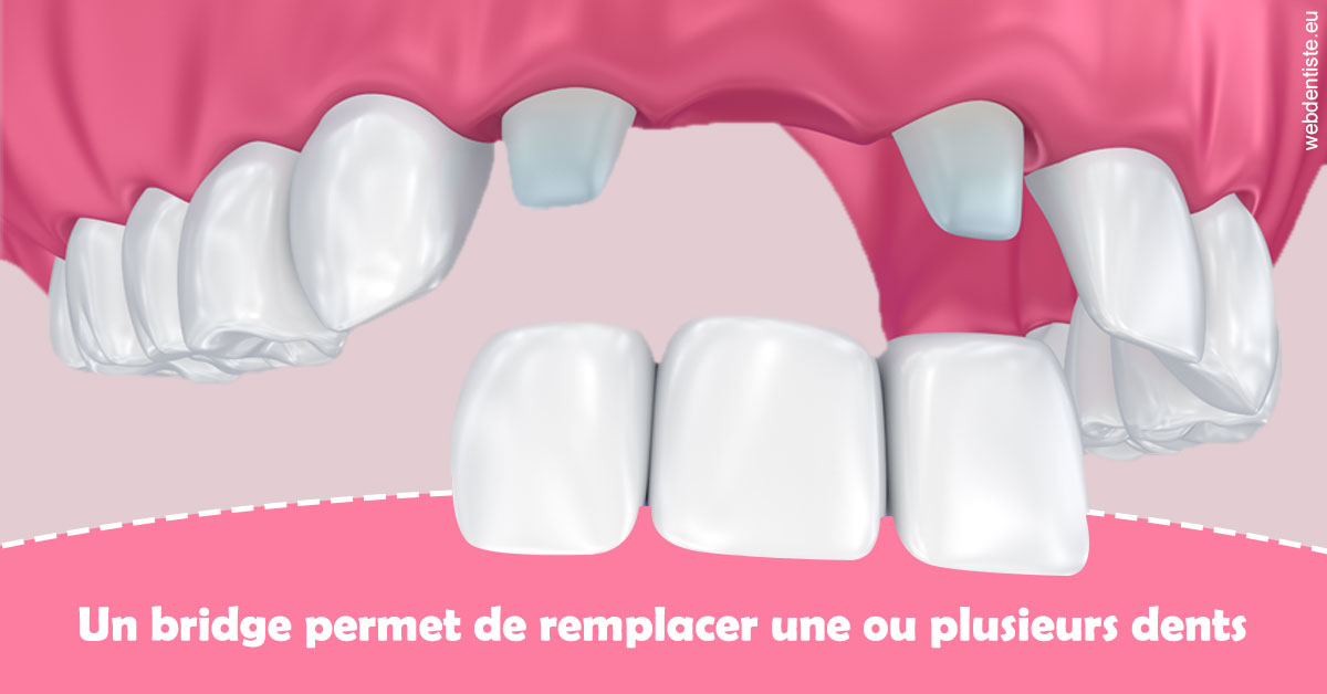 https://dr-daas-marwan.chirurgiens-dentistes.fr/Bridge remplacer dents 2