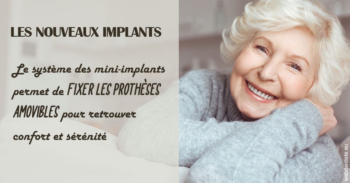 https://dr-daas-marwan.chirurgiens-dentistes.fr/Les nouveaux implants 1