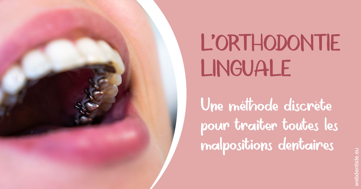 https://dr-daas-marwan.chirurgiens-dentistes.fr/L'orthodontie linguale 2