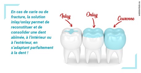 https://dr-daas-marwan.chirurgiens-dentistes.fr/L'INLAY ou l'ONLAY