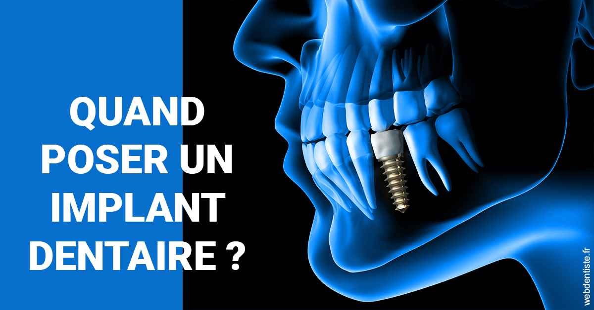 https://dr-daas-marwan.chirurgiens-dentistes.fr/Les implants 1