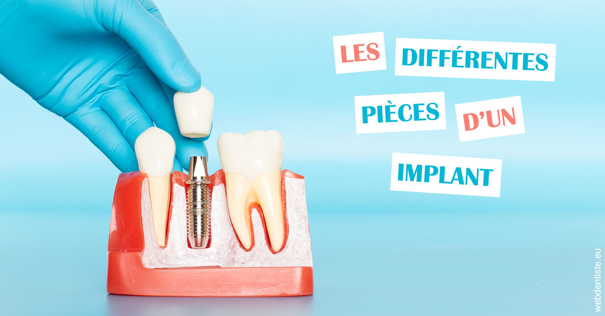 https://dr-daas-marwan.chirurgiens-dentistes.fr/Les différentes pièces d’un implant 2