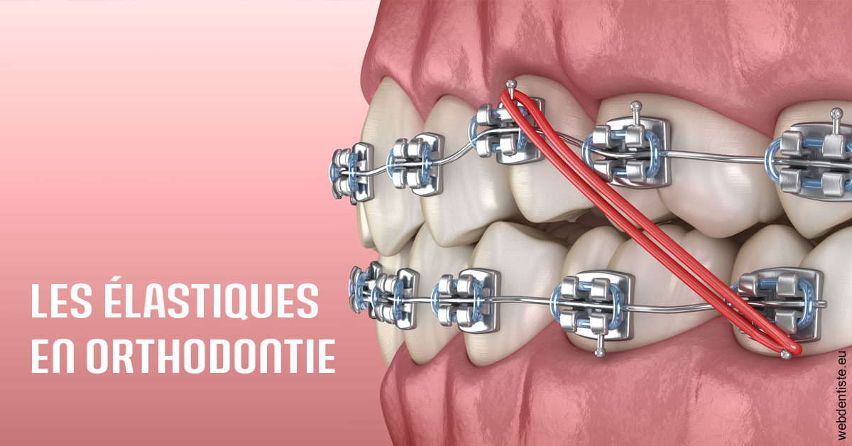 https://dr-daas-marwan.chirurgiens-dentistes.fr/Elastiques orthodontie 2