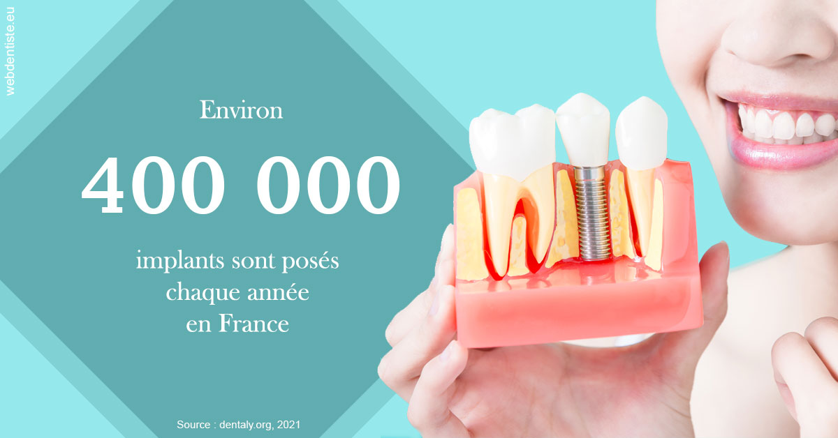 https://dr-daas-marwan.chirurgiens-dentistes.fr/Pose d'implants en France 2