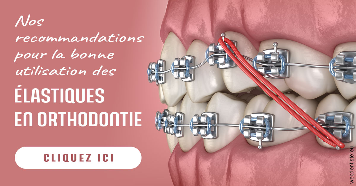 https://dr-daas-marwan.chirurgiens-dentistes.fr/Elastiques orthodontie 2